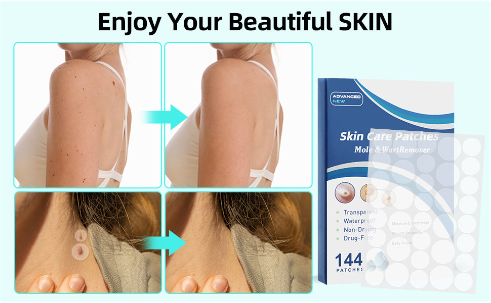 Parches para Verrugas - Tratamiento Efectivo y Discreto ¡Envió Gratis!